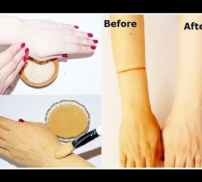 How to whiten Body Skin Fast Naturally