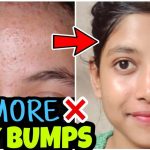 Tiny Bumps, tiny red dots, tiny pinpoints on skin