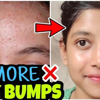 Tiny Bumps, tiny red dots, tiny pinpoints on skin