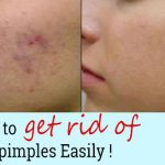 face packs with natural ingredients