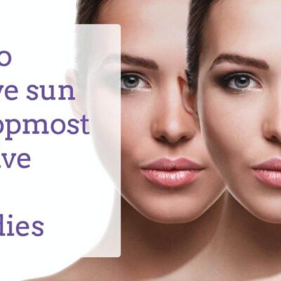 instant home remedy for sun tan