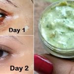 how to remove dark circles permanently at home