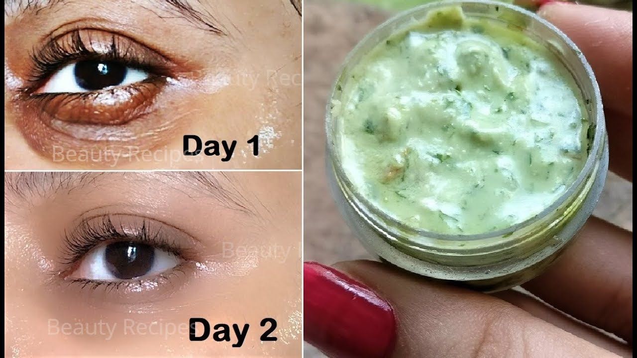 how to remove dark circles permanently at home