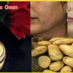 pigmentation removal cream
