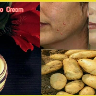 pigmentation removal cream