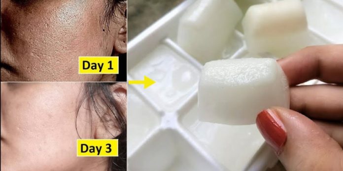 Rice Water Ice Cubes For Skin Whitening