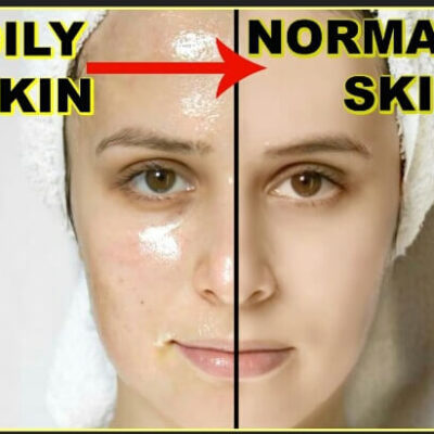natural skin care routine for oily acne prone skin