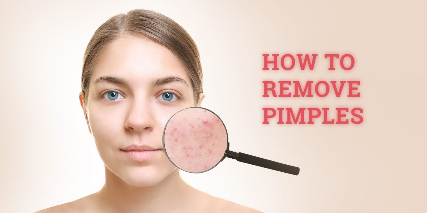 How To Remove Pimples Naturally And Permanently Recibeauty