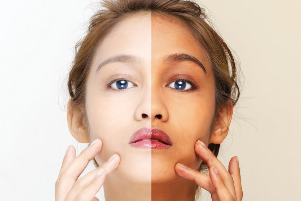 Japanese secret to whiten 10 shades that remove wrinkles and pigmentation for snow white skin