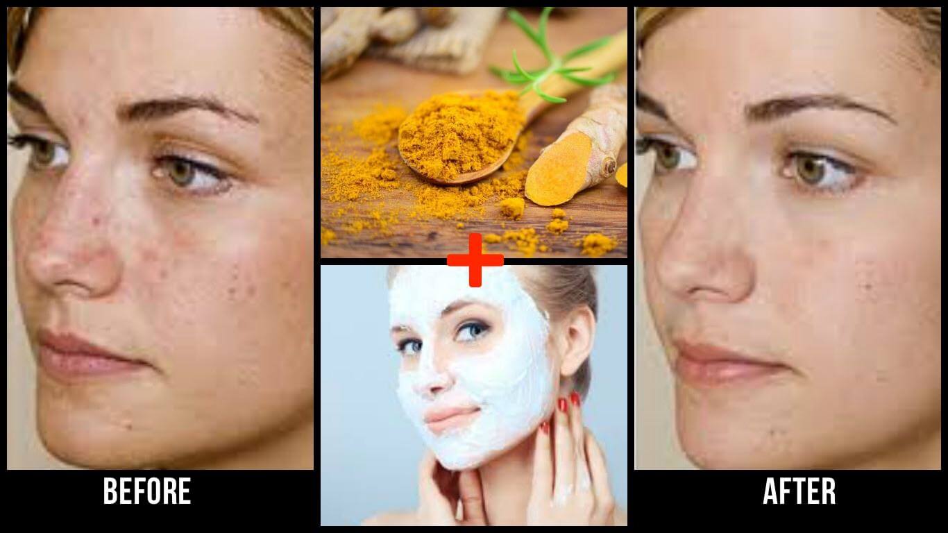benefits of turmeric on face