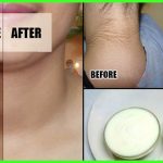 black neck