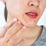 red spots on skin: causes and treatment