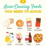 Foods to avoid for acne