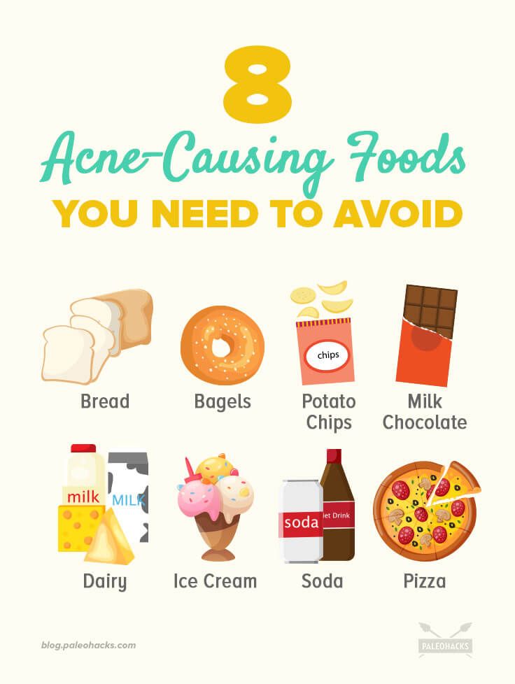 Foods to avoid for acne