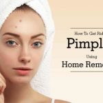 Homemade treatment for pimple