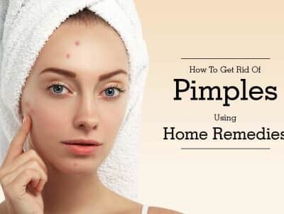 Homemade treatment for pimple