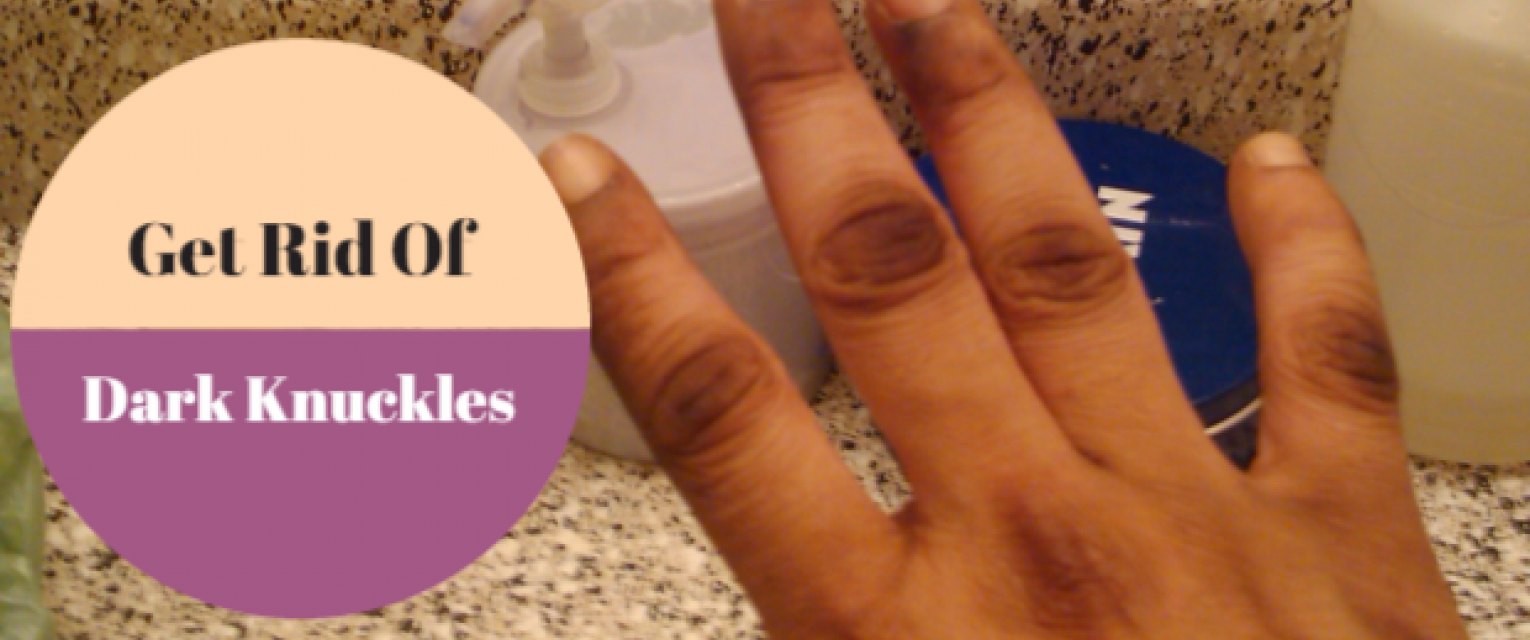 Dark knuckles: Causes and home remedies