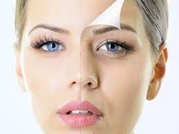 Get rid of wrinkles naturally