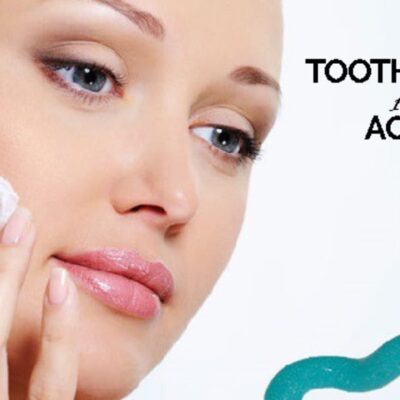 toothpaste on pimple