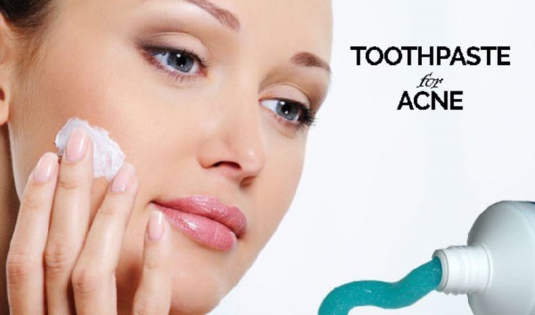 toothpaste on pimple