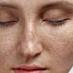 home made face packs to remove pigmentation