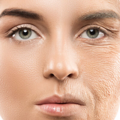 Reduce wrinkles and fine lines