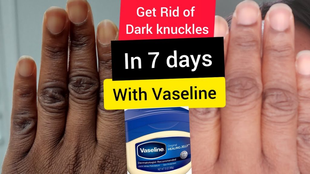 How To Use Vaseline For Dark Knuckles 2365