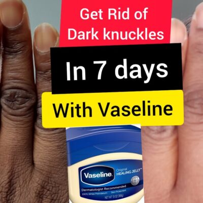 How to use vaseline for dark knuckles