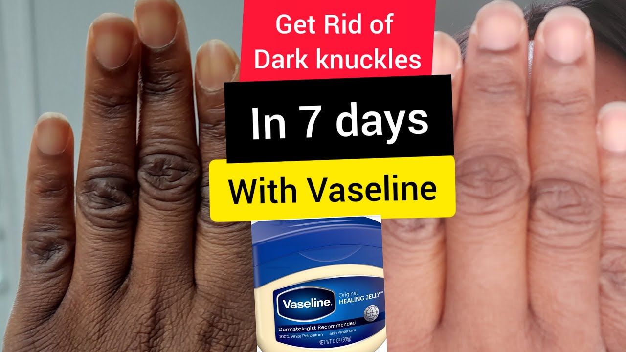 How to use vaseline for dark knuckles