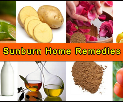 Home Remedies For Sunburn that will ease pain, itching, and redness in no time.