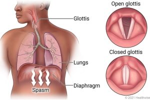 All about hiccups