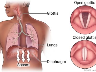 All about hiccups