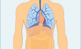 Mesothelioma: Causes, symptoms, risk factors, symptoms near death, life expectancy and treatment