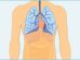 Mesothelioma: Causes, symptoms, risk factors, symptoms near death, life expectancy and treatment