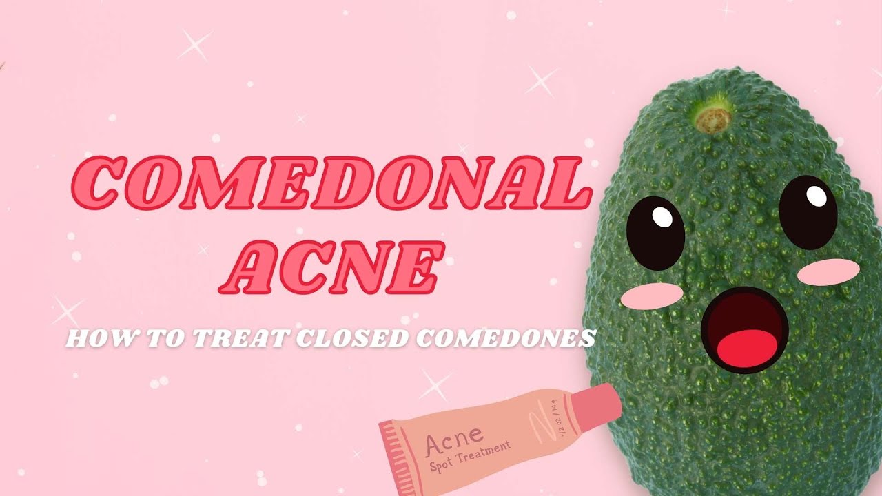 Comedones are a type of skin lesion commonly associated with acne